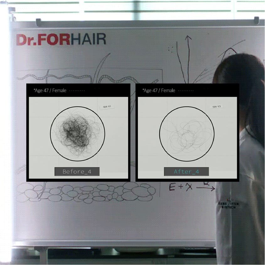 DR.FORHAIR DRFORHAIR FOLLIGEN BIO 3 SHAMPOO 500ML – online store