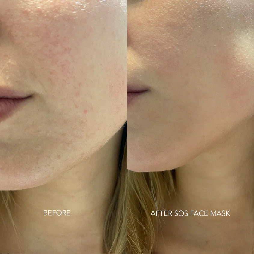 MASQMAI SOS FACE MASK 50ML – صورة 8