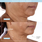 NUFACE نيوفيس ترينيتي+ ستارتر كيت، قطعة واحدة + 50 مل + 15 مل + قطعة واحدة – صورة 6