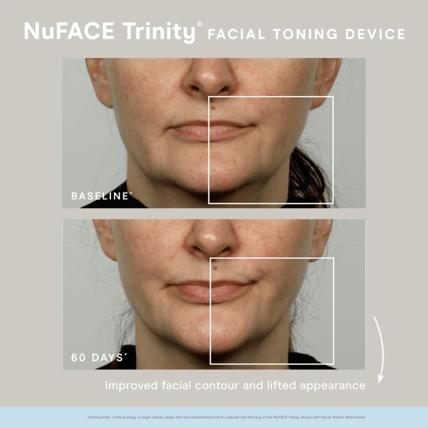 NUFACE ملحق ترينيتي لتعزيز الشفاه والعينين – توصيل مجاني