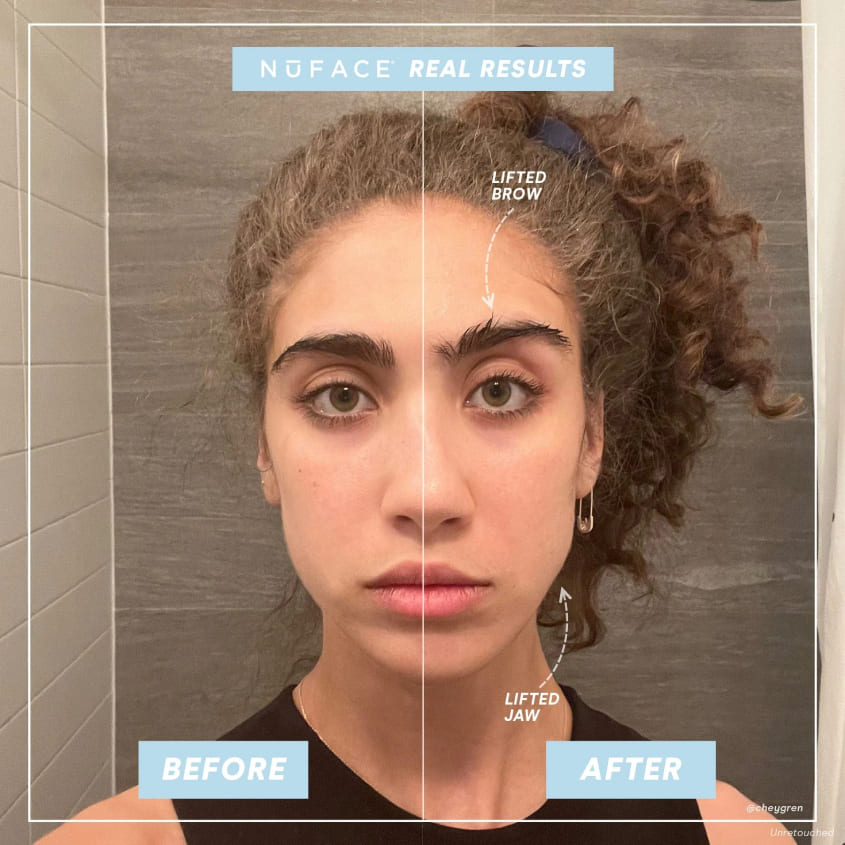 NUFACE ملحق ترينيتي لتعزيز الشفاه والعينين – صورة 6