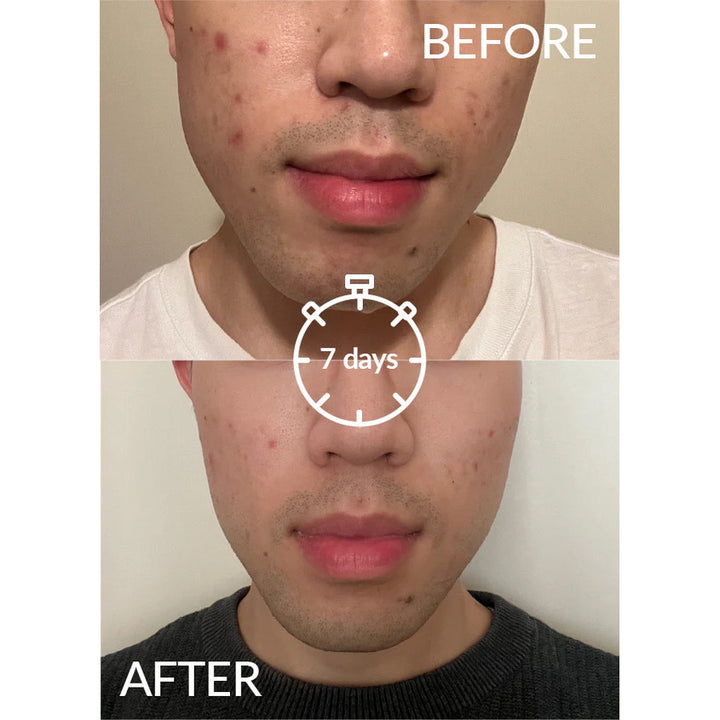 SERUM PURIFIANT L5 30ML