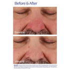 Rozatrol® Serum
