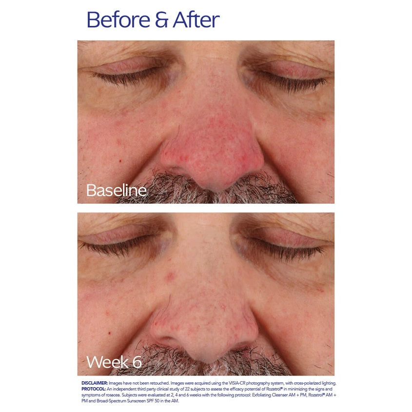 Rozatrol® Serum