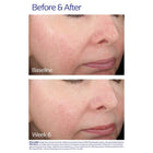 Rozatrol® Serum