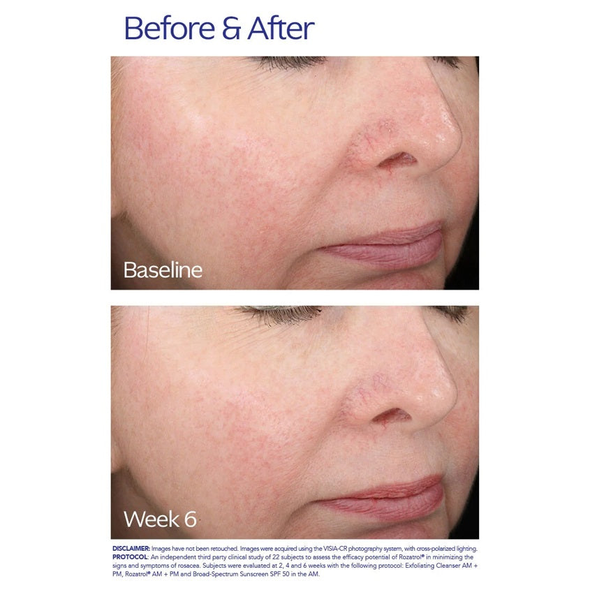 Rozatrol® Serum